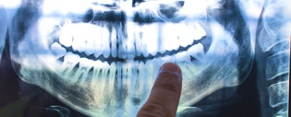 x-ray of mouth