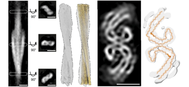 Imaging of proteins