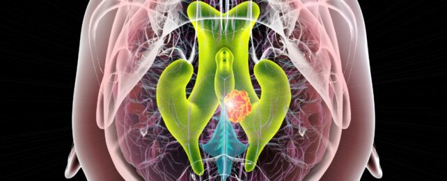 Illustration of ventricles in a brain