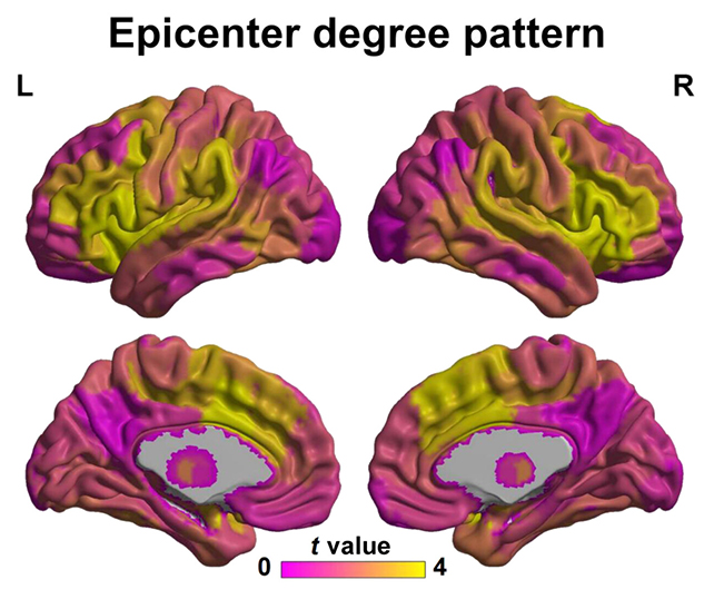 Epicenter mapping