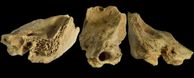 Three different views of a temporal bone