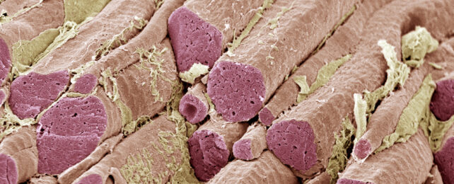 skeletal muscle fibers under a scanning electron microscope